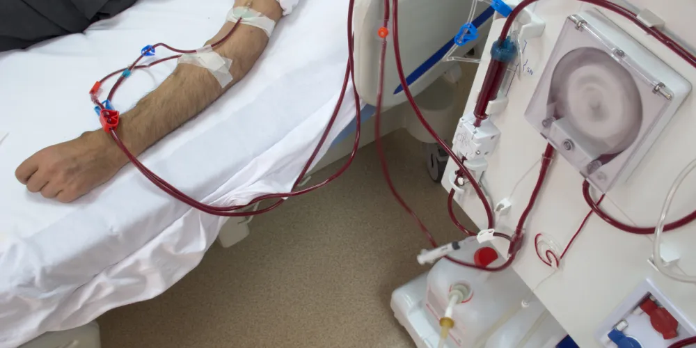 Dialysis